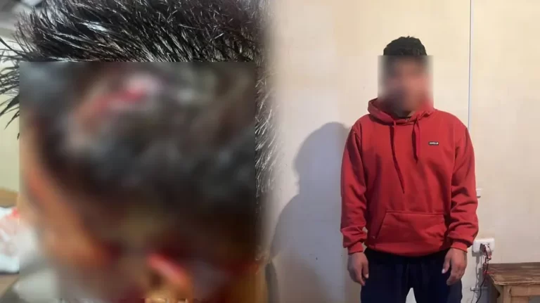 Pelea entre internos de El Abra deja a uno herido con lesiones en la cabeza
